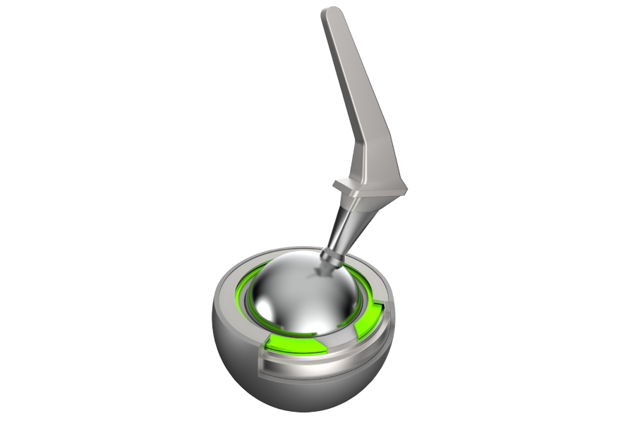 Rendered image of a spiral retaining ring securing a component in a hip implant assembly.