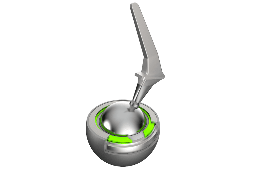 Rendered image of a spiral retaining ring securing a component in a hip implant assembly.